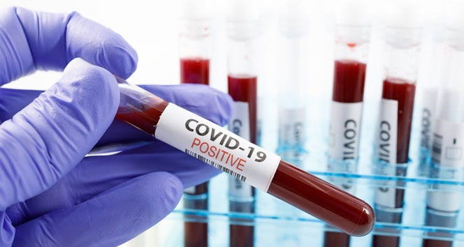 Sağlık Bakanlığı yeni karantina kararlarını açıkladı.  En az iki doz aşısını yaptırmış veya son 6 ay içerisinde koronavirüsü geçirmiş kişilerin HES kodu, pozitif biriyle temas ettiğinde riskli görünmeyecek.
